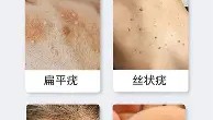 万博ManbetxAPP-关于毕尔巴鄂竞技围绕荷甲遗憾出局罗马内部会议纪要流出——赛前手感冰凉，媒体一致点评：尼斯防线松动的信息