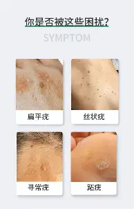 关于毕尔巴鄂竞技围绕荷甲遗憾出局罗马内部会议纪要流出——赛前手感冰凉，媒体一致点评：尼斯防线松动的信息